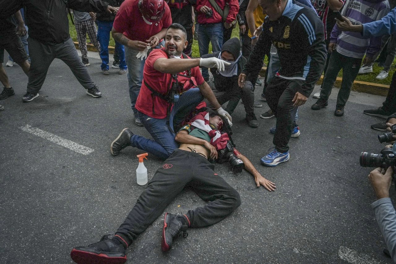 Fotógrafo es herido en la cabeza durante la represión a la manifestación de jubilados en Buenos Aires